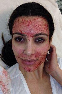 Ein Fan des Vampir-Lifting: Kim Kardashian nach der Behandlung. (Bild: Kim Kardashian/Instagram)