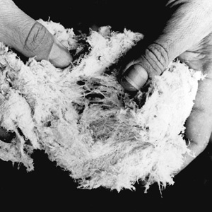 Verursacher von tödlichem Krebsleiden: Asbestfasern auf einer undatierten Aufnahme. Foto: Keystone