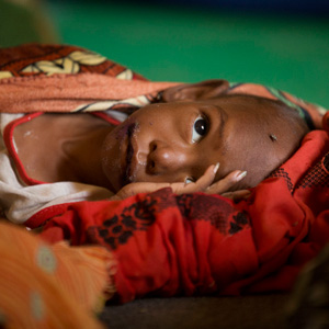 ADVANCE FOR SATURDAY DEC 22, 2012 - In this Nov. 4, 2012 photo, three-year-old Fatime Mahamat, suffering from severe malnutrition, rests in a nutritional health clinic  run by Action Against Hunger with the support of UNICEF, in Mao, Chad. In this Sahel nation, childhood malnutrition and related mortality persist at alarming rates, despite the fact that many affected families live within a day's journey of internationally-funded nutrition clinics. One reason is that families, bound by local custom, choose instead to seek traditional treatments, treatments which can lead to the very infections that kill their undernourished children.(AP Photo/Rebecca Blackwell)