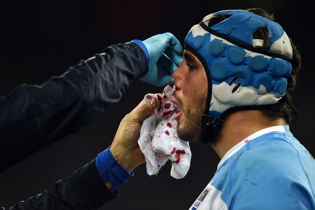 Argentina's prop Lucas Noguera is seen to by a medic during the bronze medal match of the 2015 Rugby World Cup between South Africa and Argentina at the Olympic Stadium, east London, on October 30, 2015. AFP PHOTO / PAUL ELLIS RESTRICTED TO EDITORIAL USE, NO USE IN LIVE MATCH TRACKING SERVICES, TO BE USED AS NON-SEQUENTIAL STILLS